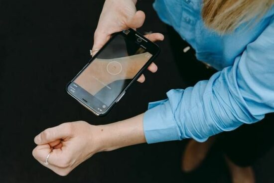 woman scanning skin spot with SkinVision app